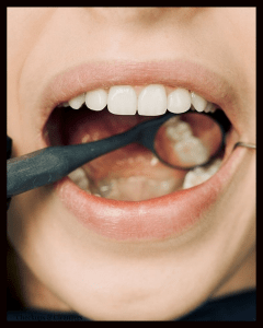 Close-up of mouth during dental exam with mirror and tool